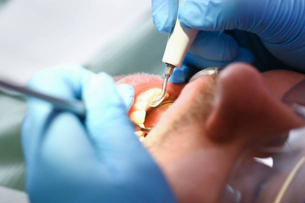 Best Dental Abscess Treatment in Budd Lake, NJ
